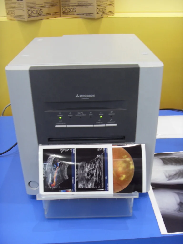 P93C Black and White Ultrasound Thermal  video printer