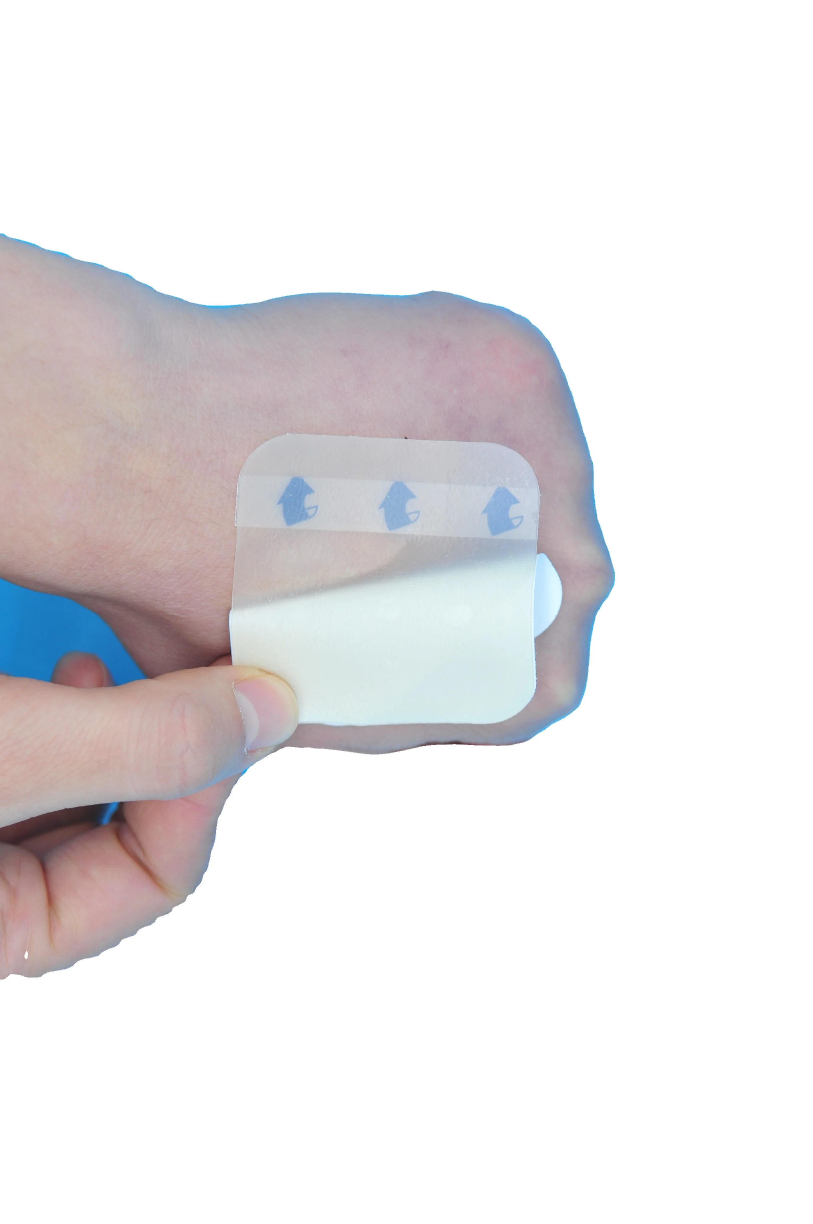 Ultra-thin Hydrocolloid Wound Dressing For Ulcer Wound Care Hydrocolloid Patch China Medical Hydrocolloid Dressing