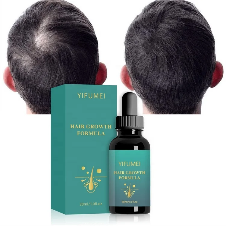 Advance Ginger Ginseng Polygonum Grapeseed Oil Regrowth Hair Loss And Thickening Treatment Serum For Hair Growth