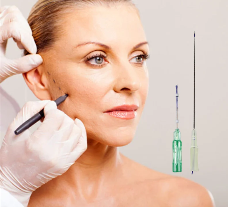 Pdo Thread Wholesale Price Lift CE Cog Polydioxanone Filling Face Korea