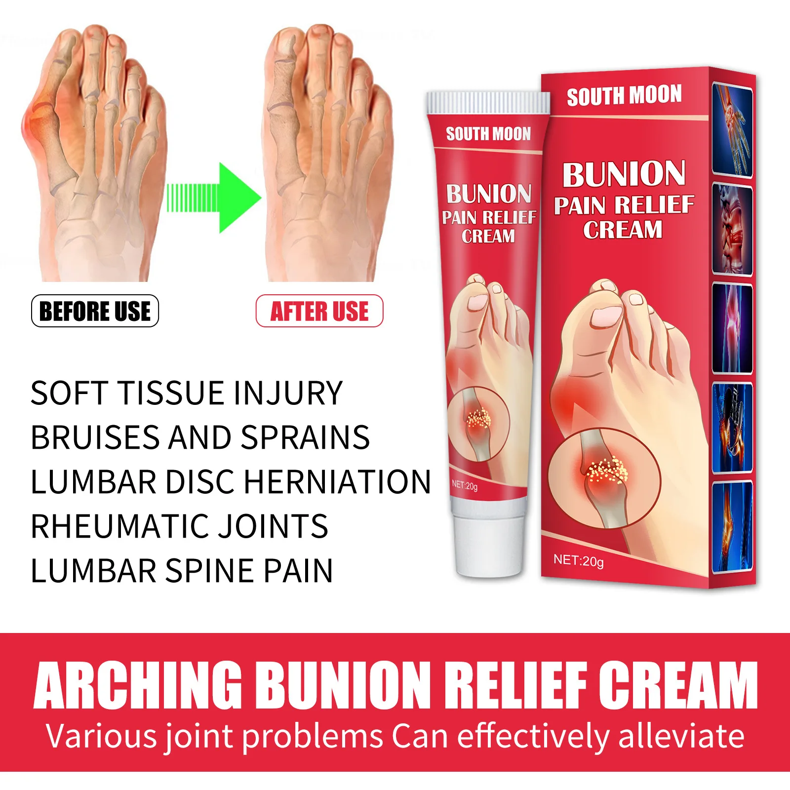 South Moon 20g Bunion Pain Relief Ointment Joint Toe Pain Cream Bunion Gout Pain Relief Stiffness Inflammation Treatment