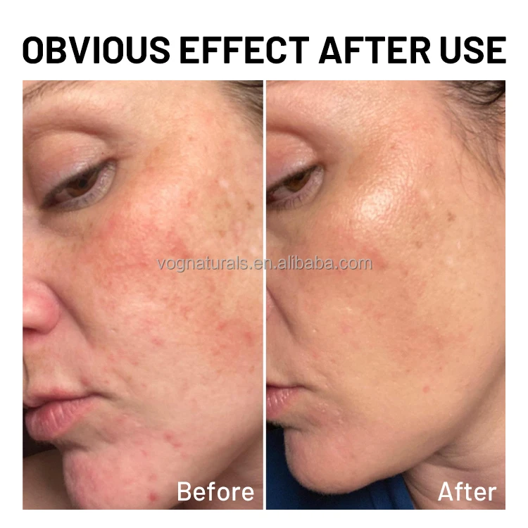 Rice facial care set 3