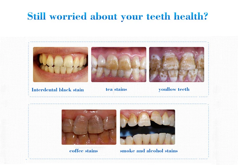 OEM Yellow Stains Teeth Treatment Smoke Coffee Plaque Dental Tools Oral Hygiene Remove White Tooth Care Teeth Whitening Essence