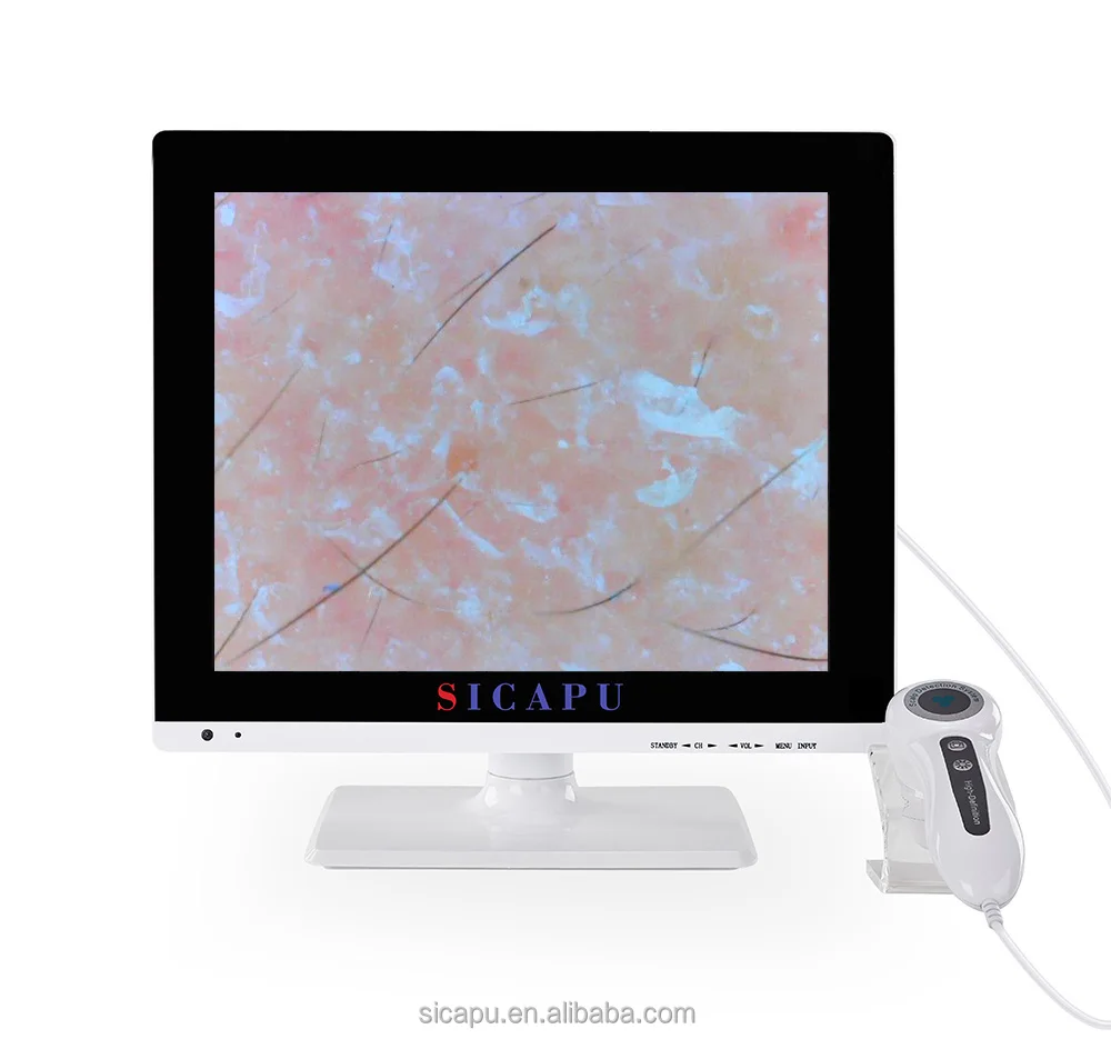 Ai Intelligent Automatic Portable Skin Hair Scalp Analyser With Usb Scalp Scanner Camera Wireless Hair Analysis Machine