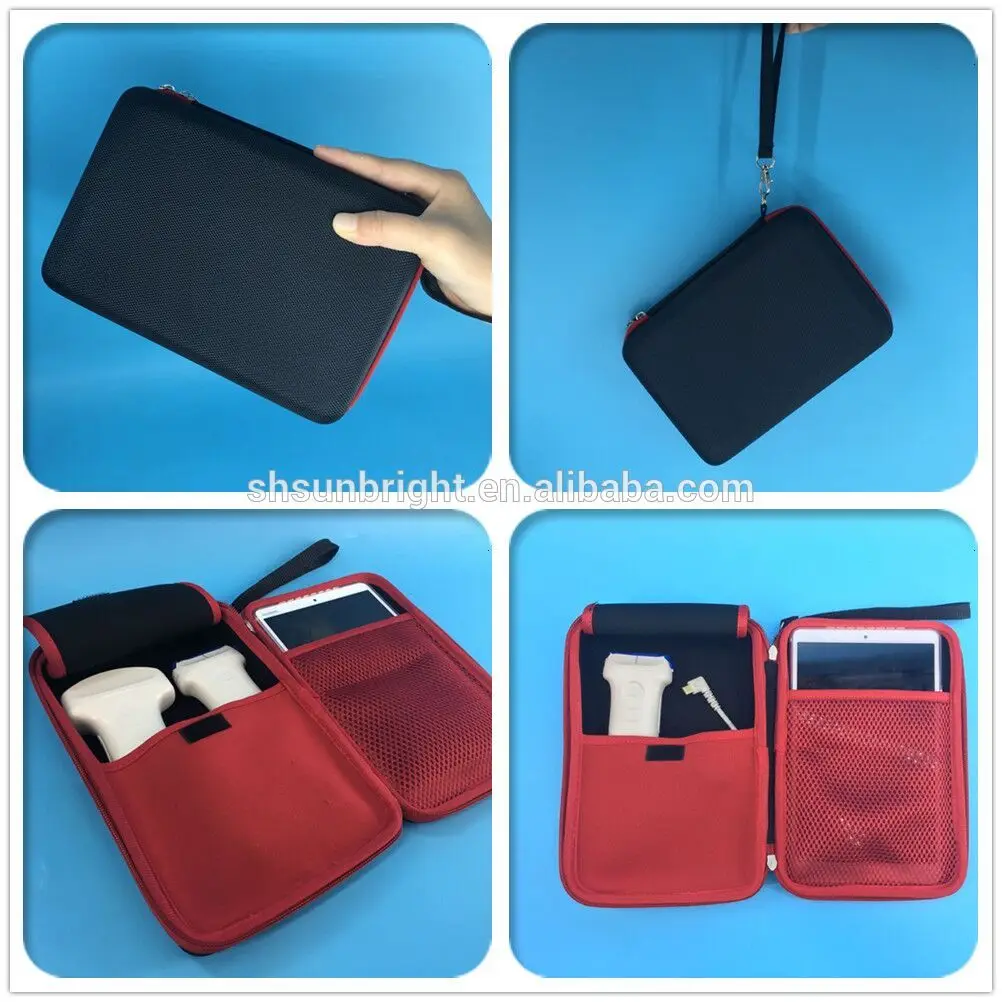 Wifi ultrasound USG wireless ultrasound probe type C connector IOS android mobile device