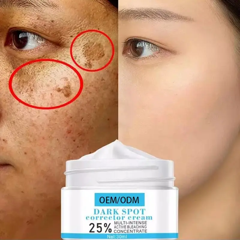 Pimples Melasma Blemish Removal Dark Spot Remover Cream Strong Bleaching Whitening Face Freckles Remove Corrector Cream