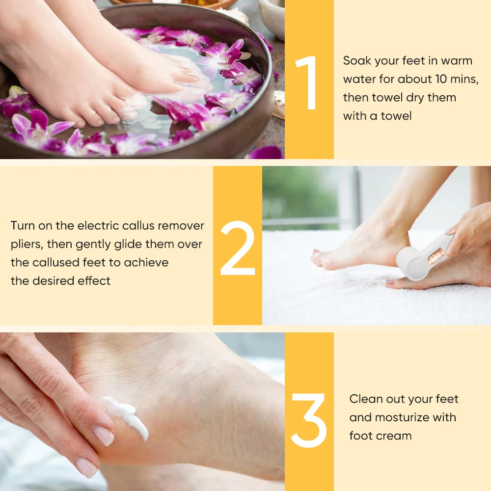 Pedicure Products Kit Pumice Stones Removedor De Calos Callus Remover Pedicure Machine With 3 Rollers