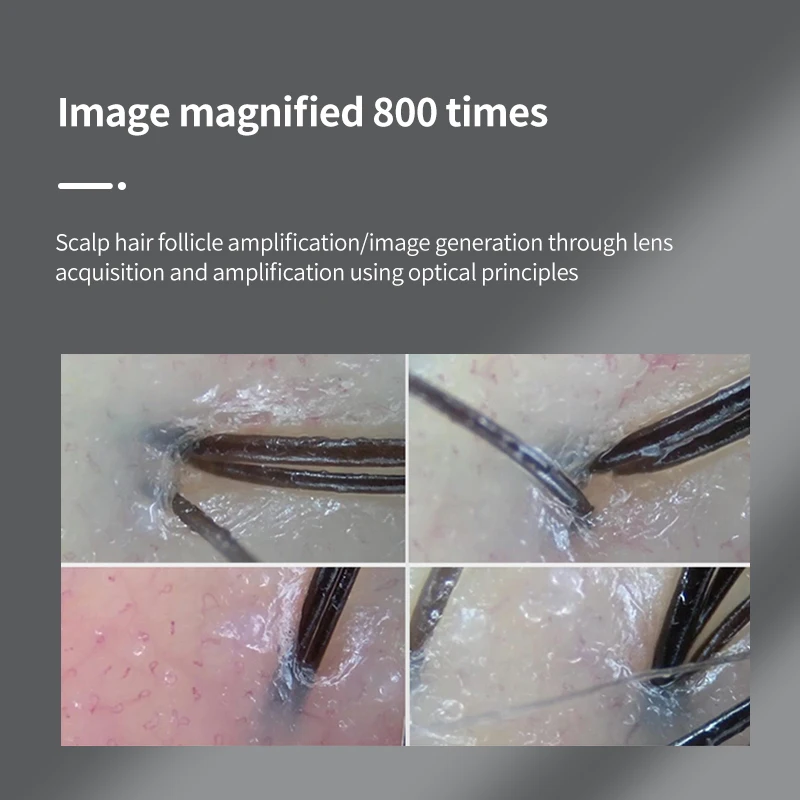 Skin Analyzer Scalp Hair Camera Scanner Wireless WiFi Connection Compatible with Android Ios System