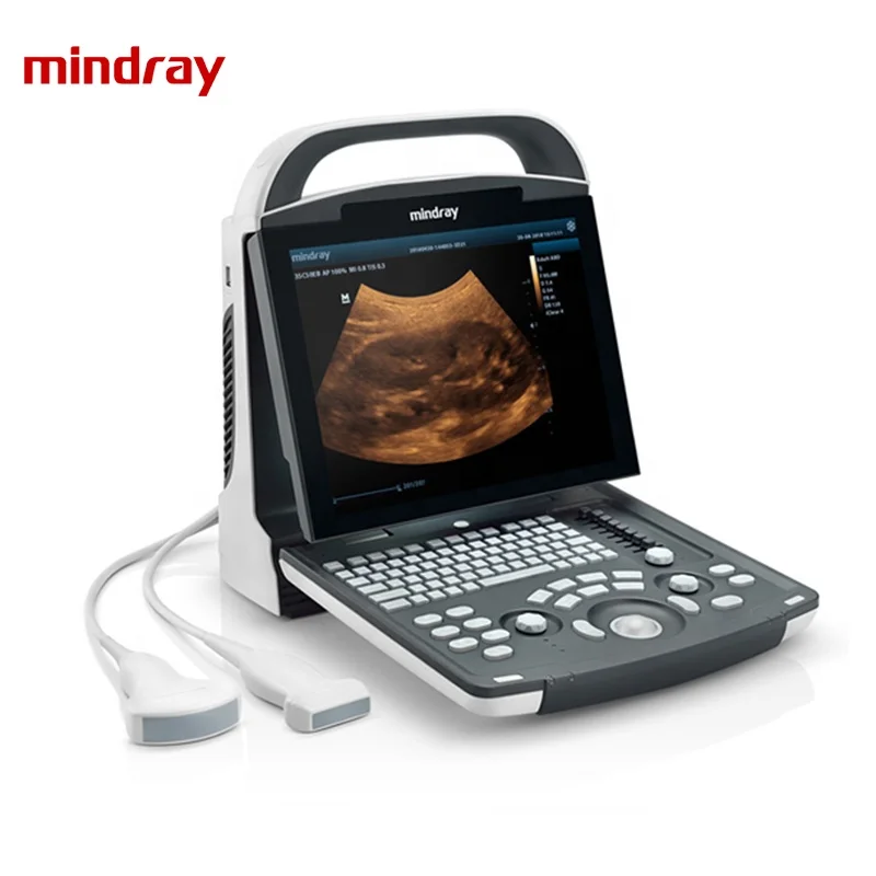Mindray DP-20 портативный ультразвуковой цена УЗИ аппарат медицинское ультразвуковое оборудование для продажи