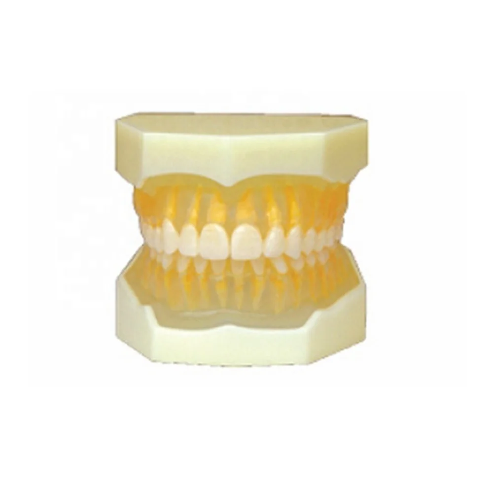 Tooth extraction jaw model removable dental teeth model