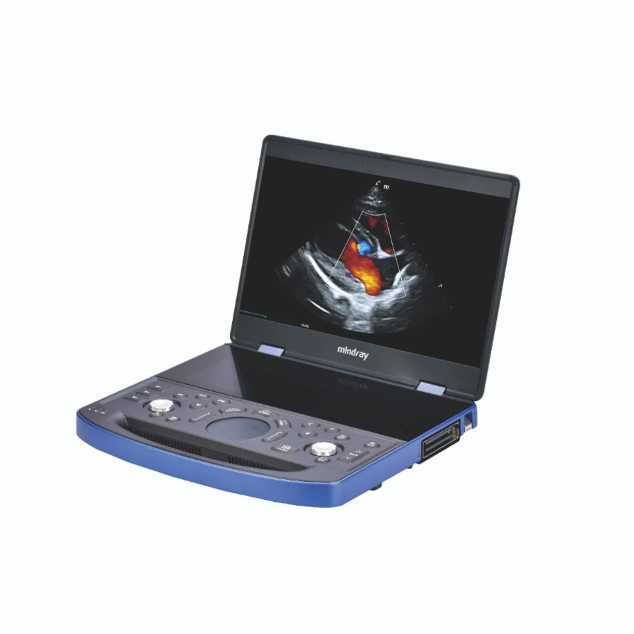 Mindray Vetus E7/MX7 Portable Ultrasound Imaging System For Veterinary Use hospital