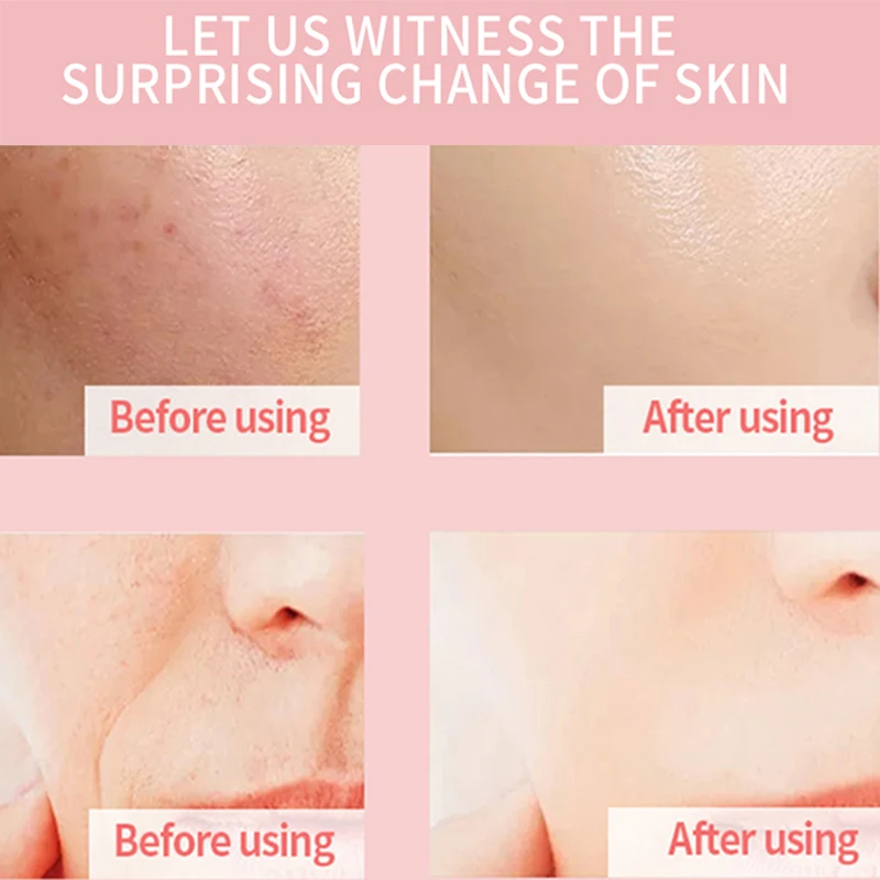 Free Sample Skin Care Hyauloronic Collagen Niacinamide 4 in 1 Face Serum Vitamin C Facial Serum