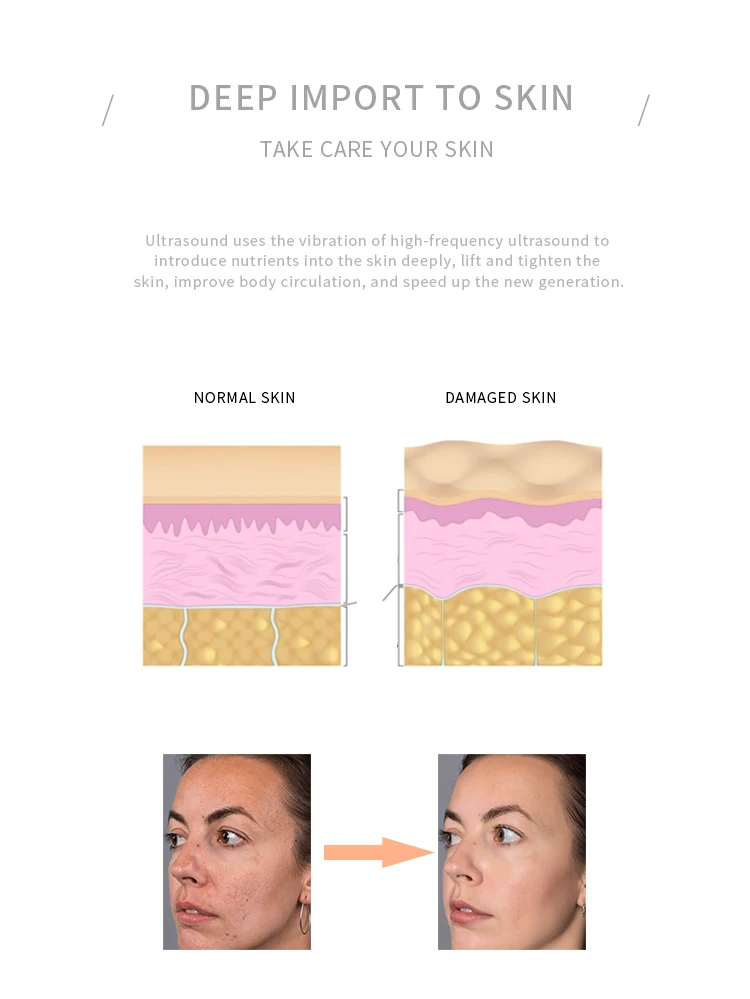 facial skin tightening