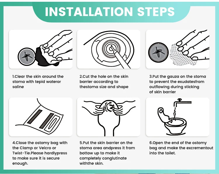Drainable Pouch Ostomy Bags One Piece two piece Colostomy Bag Pouch