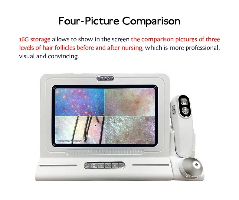 2025 Meiboyi High Quality HD UV Light Handheld hair Analyzer machine Portable Scalp Analysis Detector for Beauty Salons Products