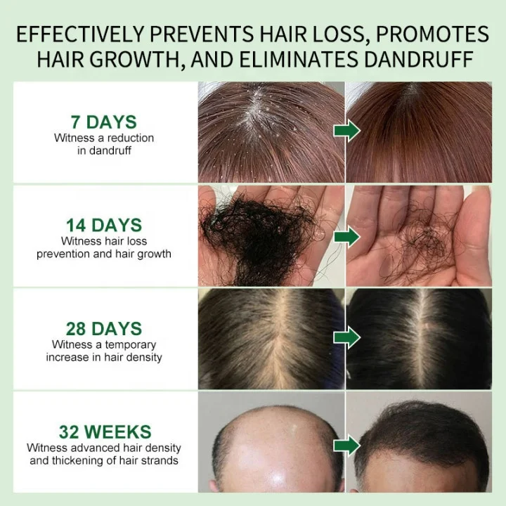 Rosemary Scalp Oil Organic Natural 7 Days Hair Tonic Free Hair Growth Oil for Alopecia Gallon Big Bottle Serum