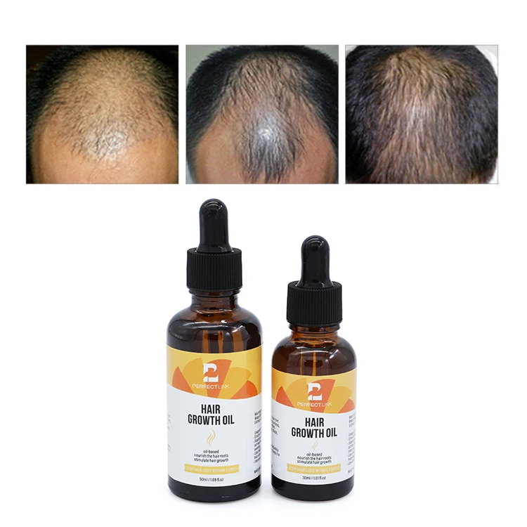 Wholesale New Arrival Hair Growth Oil with Biotin and Castor organic Hair Growth Serum For Woman