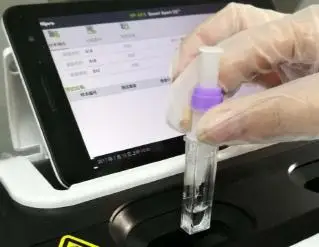 Medical diagnostic equipment Testing Top Touch screen hormones measurement Immunofluorescence Quantitative Analyzer (POCT)