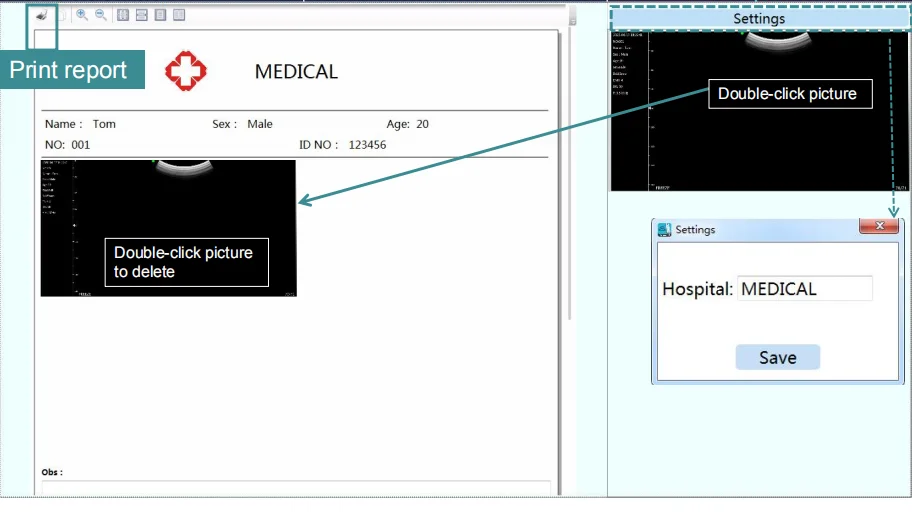 Konted gen4 pro medical ultrasound with linear probe for needle guide