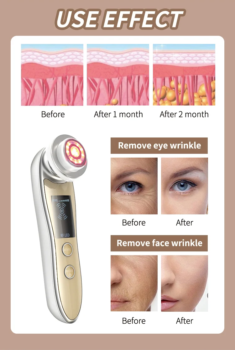 Portable Home Use Beauty Equipment Skin Rejuvenation Beauty Massage Lifting Rf Ems Beauty Device