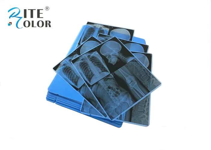 Nanjing Factory Wholesale Accurate And True Image Blue Dental X Ray Film For Kodak Printer