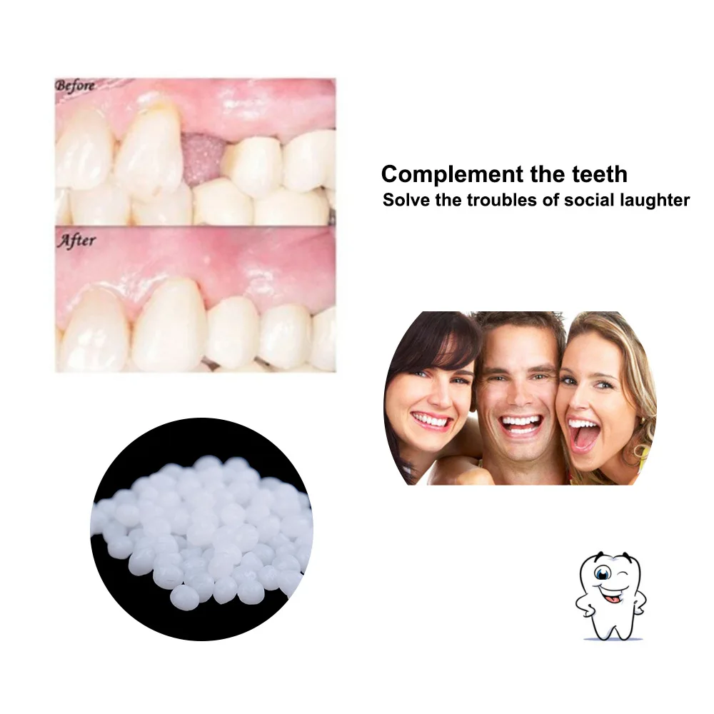 3Colors temporary Dental Oral False Fake Teeth Tooth Filling Repair Smile Snap on Veneers Dentures Case Paste Adhesive Beads