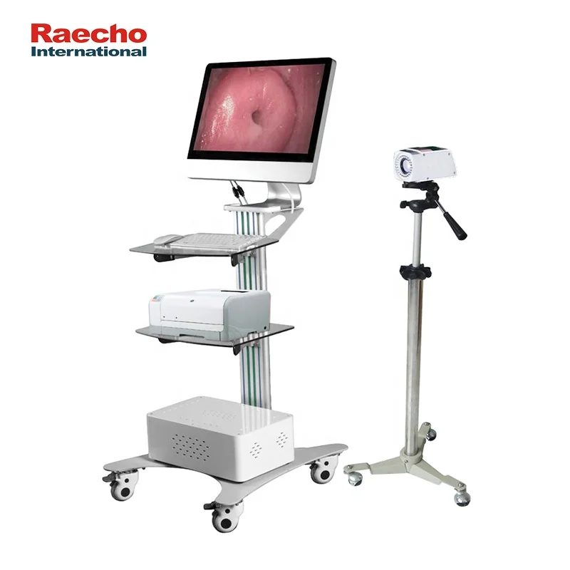 Advanced Technology Dynamic Video Colposcope Price