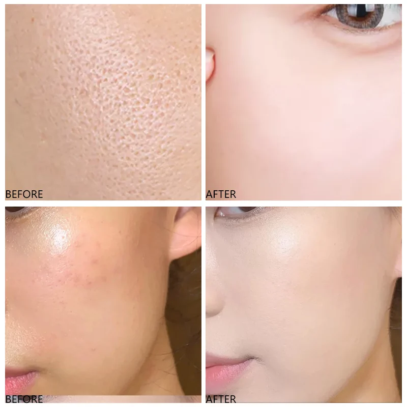 Custom Face Whitening Anti Aging Serum Brightening Hyaluronic Acid Skin Care Alpha Arbutin Vitamin C Serum