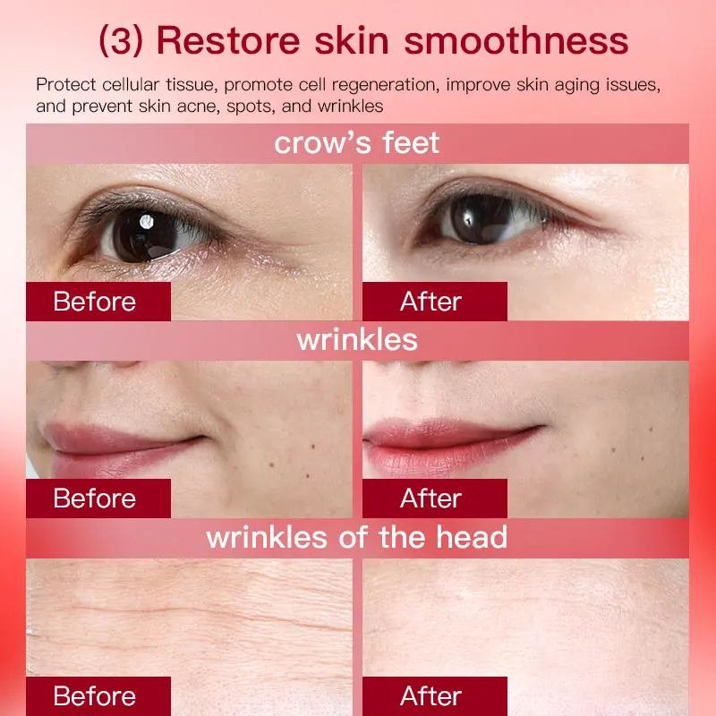 Luxury Miracle Dark Spot Corrector Serum Hexapeptide Youth Lipoic Acid Strong Whitening Vit C Serum Private Label