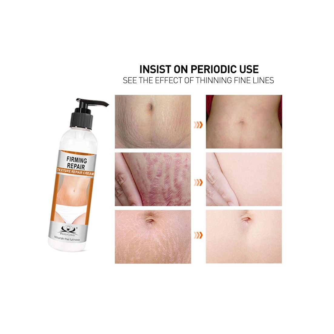 high quality and low price private label stretch mark cream, stretch marks removal cream