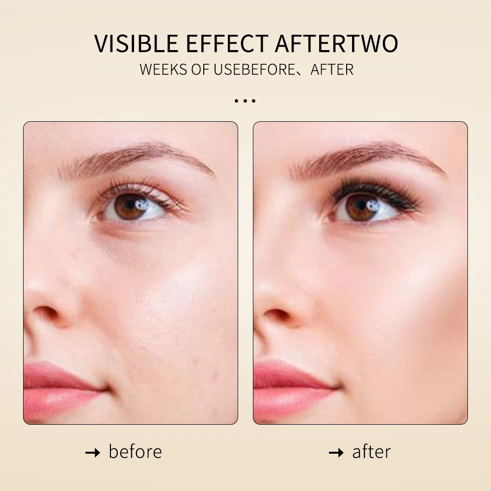 Krone Custom Natural Peony Root Extract Hyaluronic acid Niacinamide Brightening Hydrating Moisturizing Serum Skin Care Set