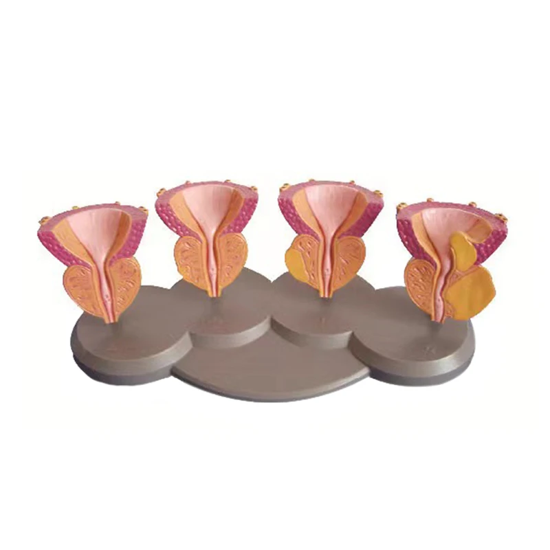 medical science educational supplies medical teaching aids prostate pathology model gift items for doctors