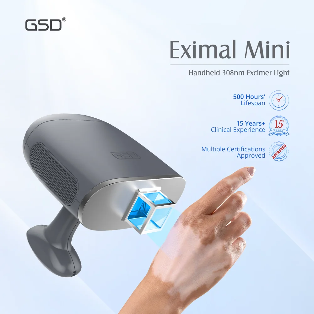 Mini Excimer Laser 308nm Psoriasis Vitiligo Laser Machine Uvb Lamps For Psoriasis Treatment uvb 311 lamp for psoriasis vitiligo
