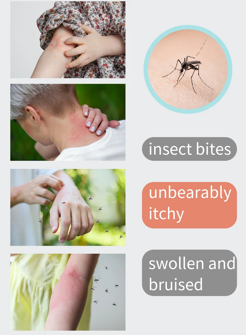 Insect Bite Healer Experience Natural, Chemical-Free Relief with Electric Heat Wand  The Ultimate Eco-Friendly Itch Eraser