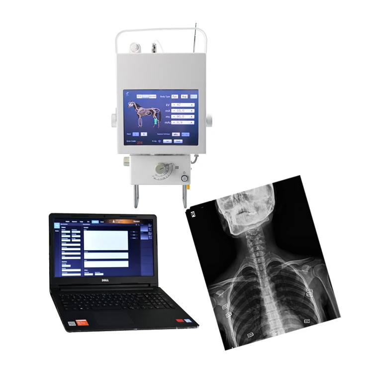 Digital X ray machine price medical radiology equipment medical hospital high frequency x ray equipment 630mA