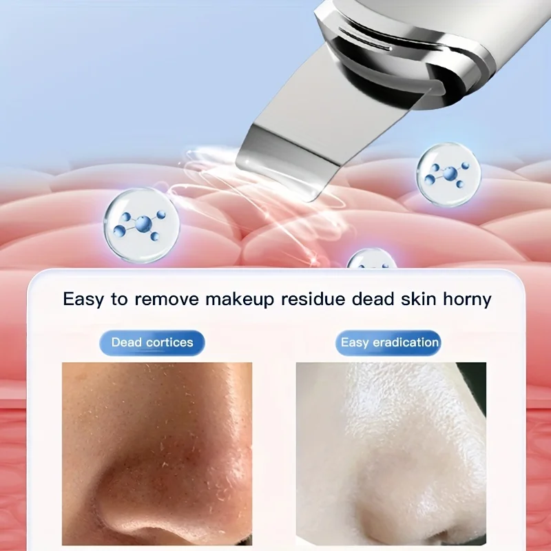 Professional Ultrasonic Skin Scrubber For Face