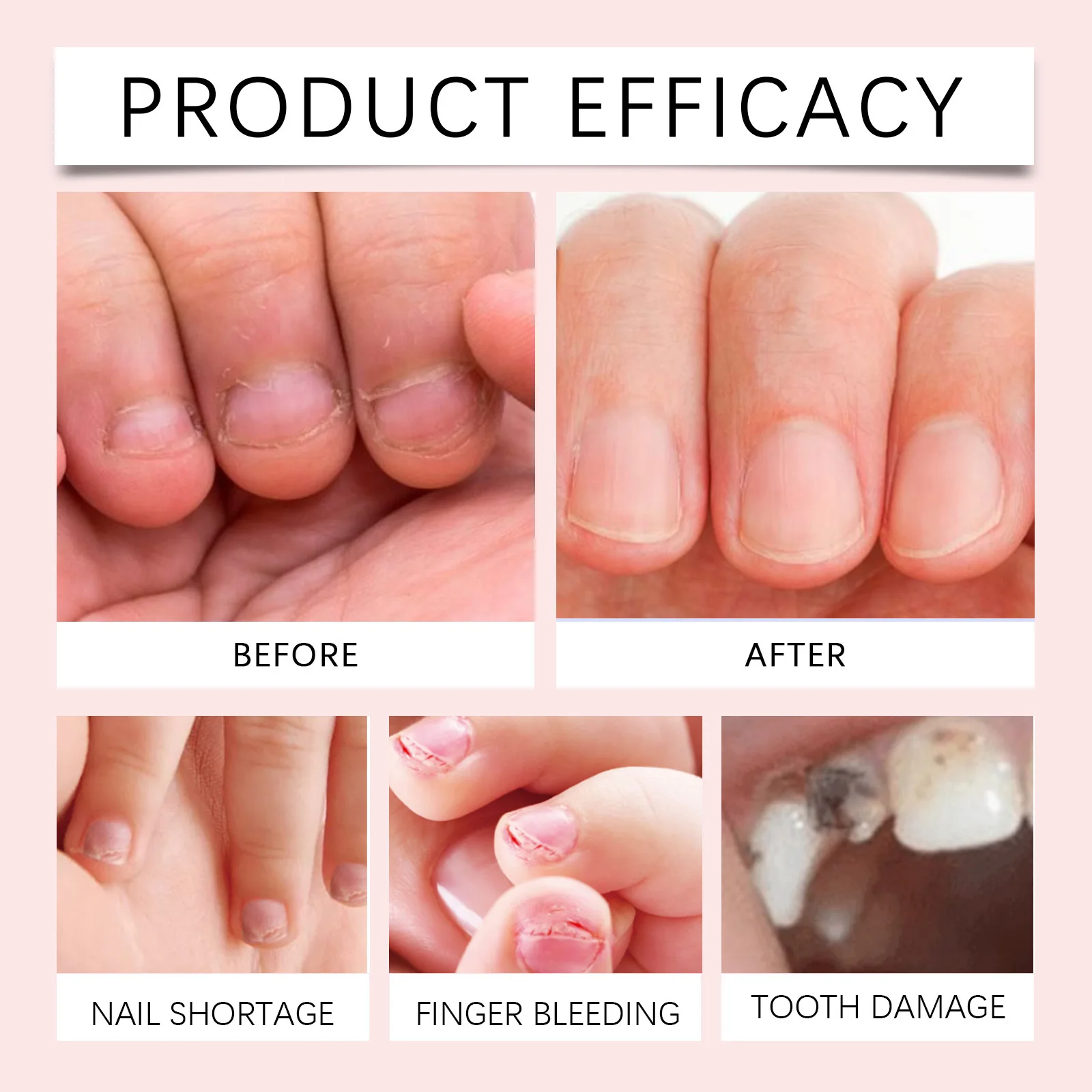 Anti Stop Nail Biting High Quality Natural Healthy Kids or Adults Nail Care Treatment Liquid Anti Biting Liquid
