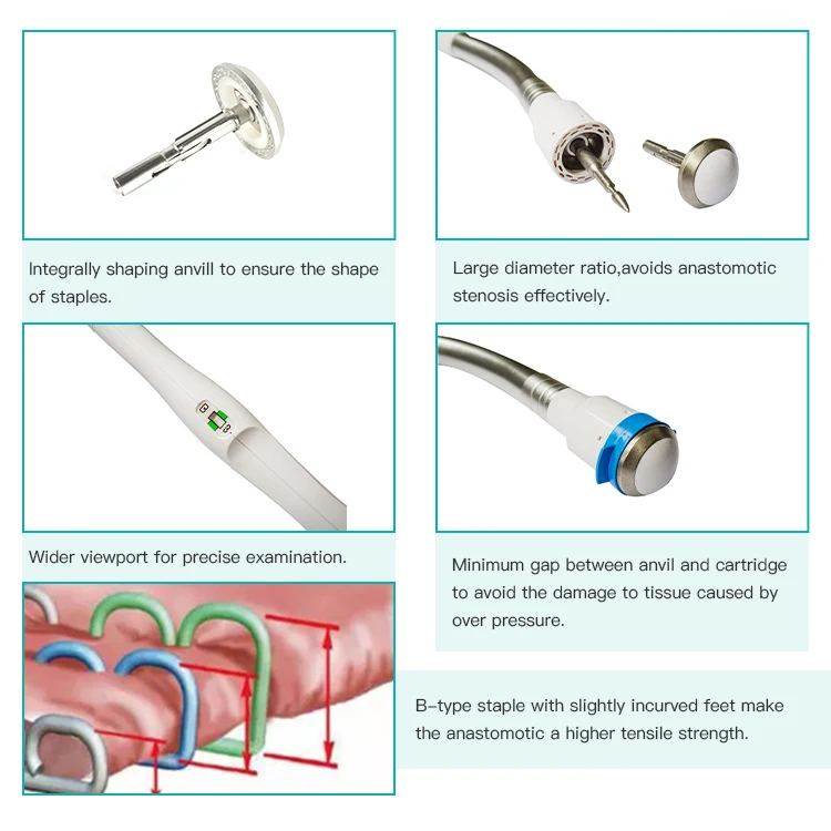 2024 Disposable Circular Stapler For Abdominal In Esophageal Gastric Intestinal Open Surgery