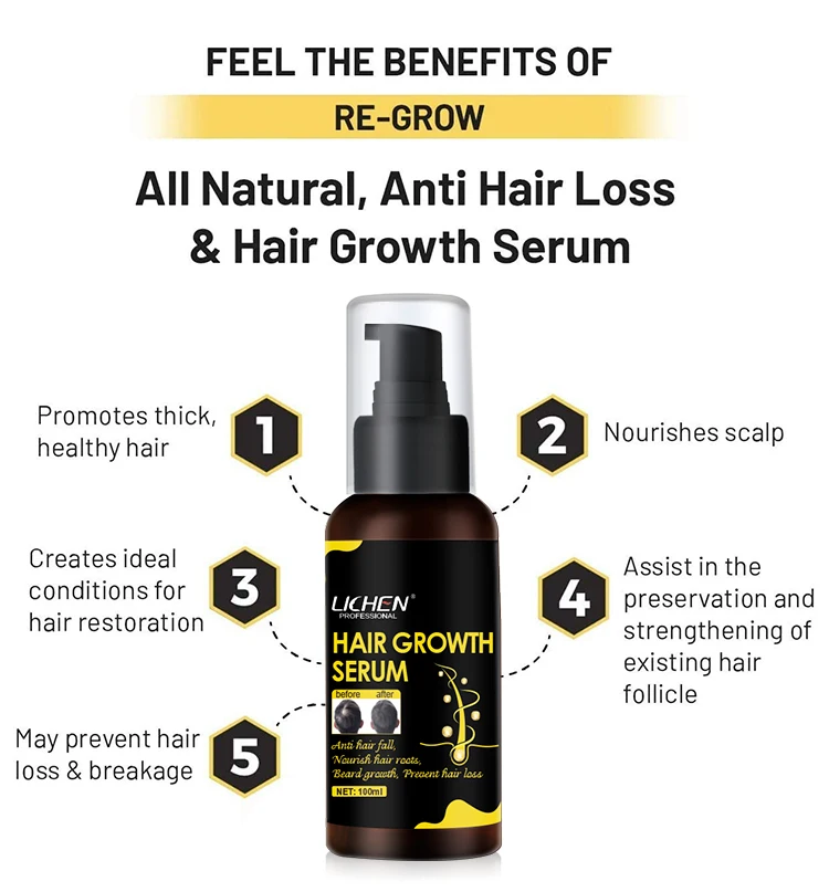 Лучший результат, сыворотки для быстрого роста волос ginger, Органическая натуральная формула, оптовая продажа для афроамериканских волос