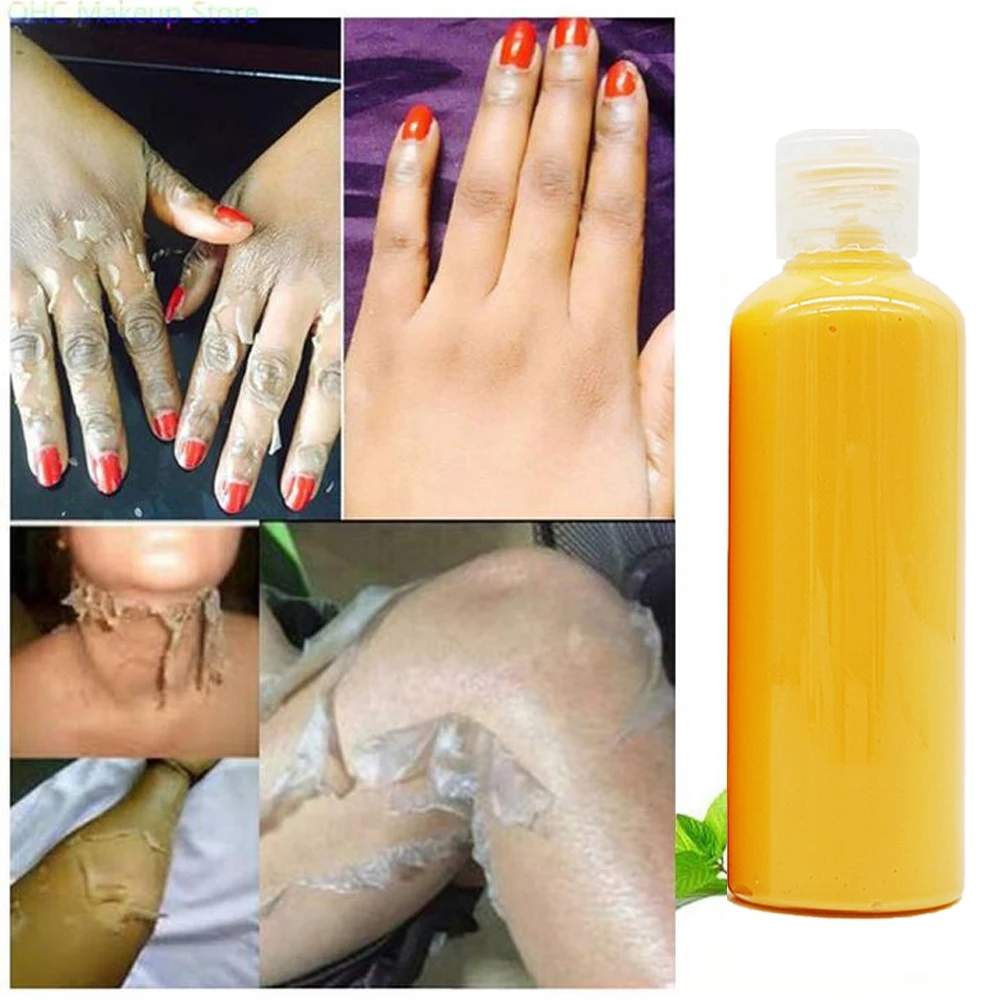OEM private label organic Peeling Lotion Wholesale Whitening Lightening Moisturizing Scars Dark Spots body lotion for dark skin