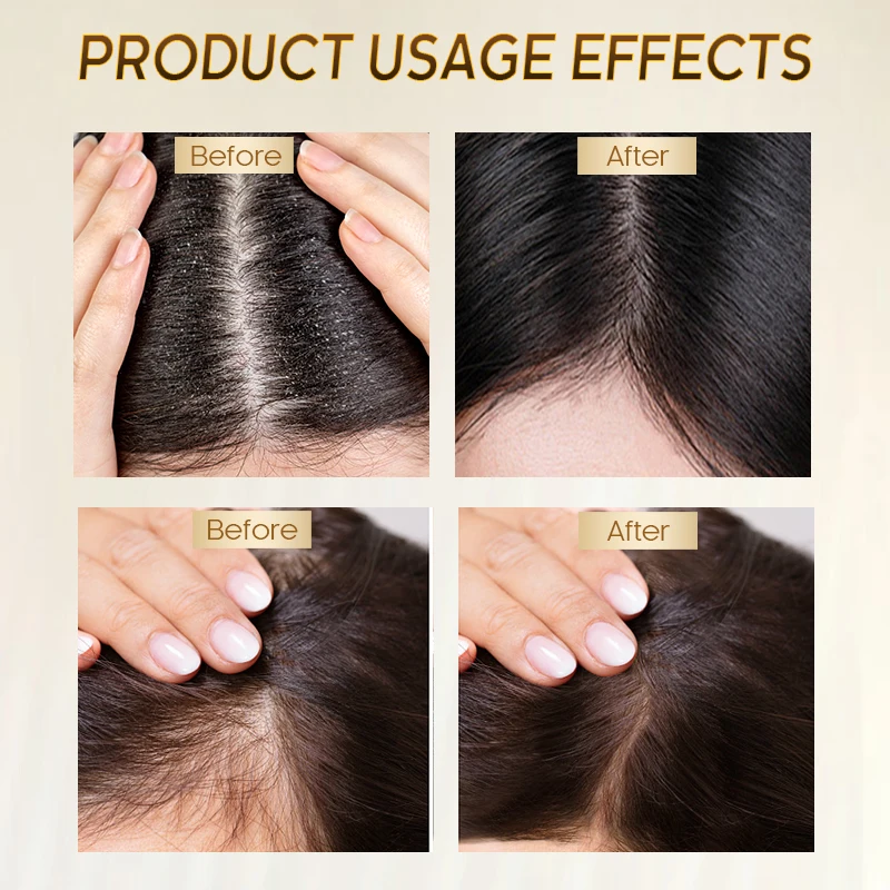 Lanaya Brazil Keratin Hair Regrowth Therapy Protein Treatment Hair Shampoo With Blowout Custom Logo Design Free