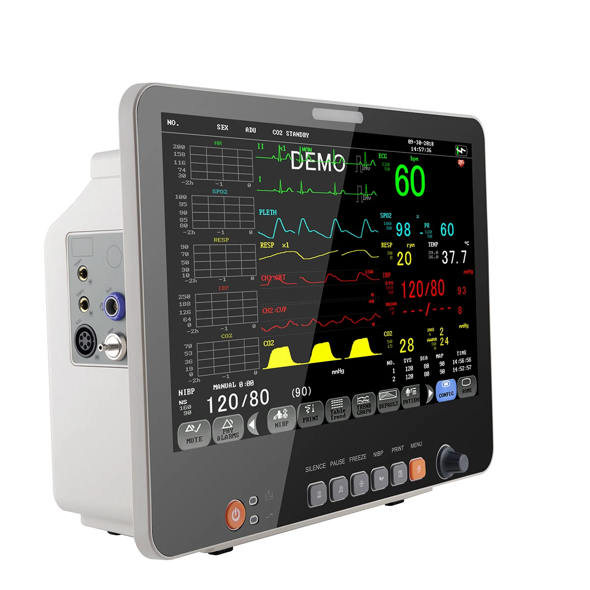 15 дюймов TFT дисплей монитор пациента icu портативный многопараметрический ветеринарный для больничной клиники