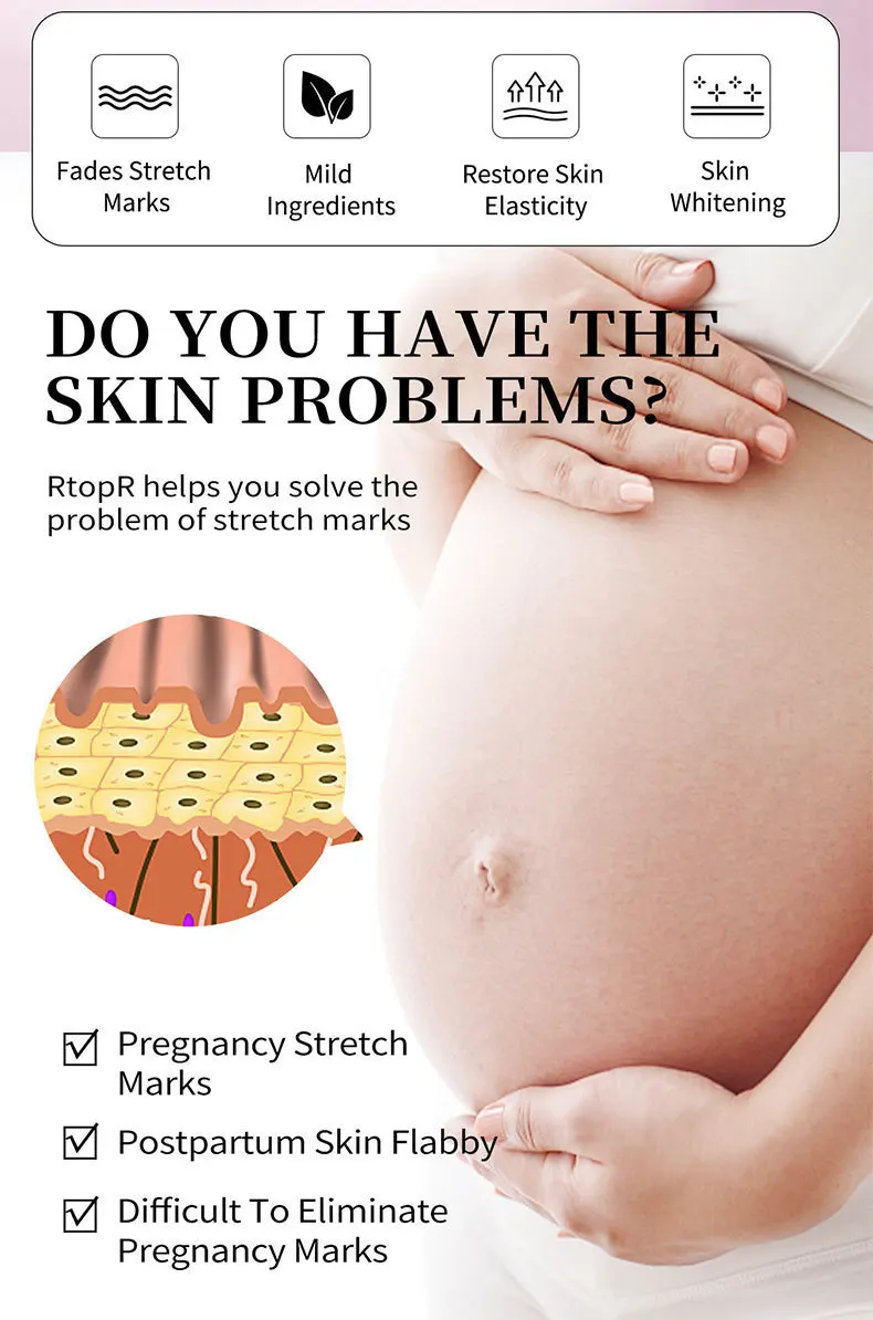 OEM ODM Natural Organic Mango Stretch Mark Repair Cream Maternity Fades Postpartum Fat Growth Orange Peel Scar Remover Skin Care