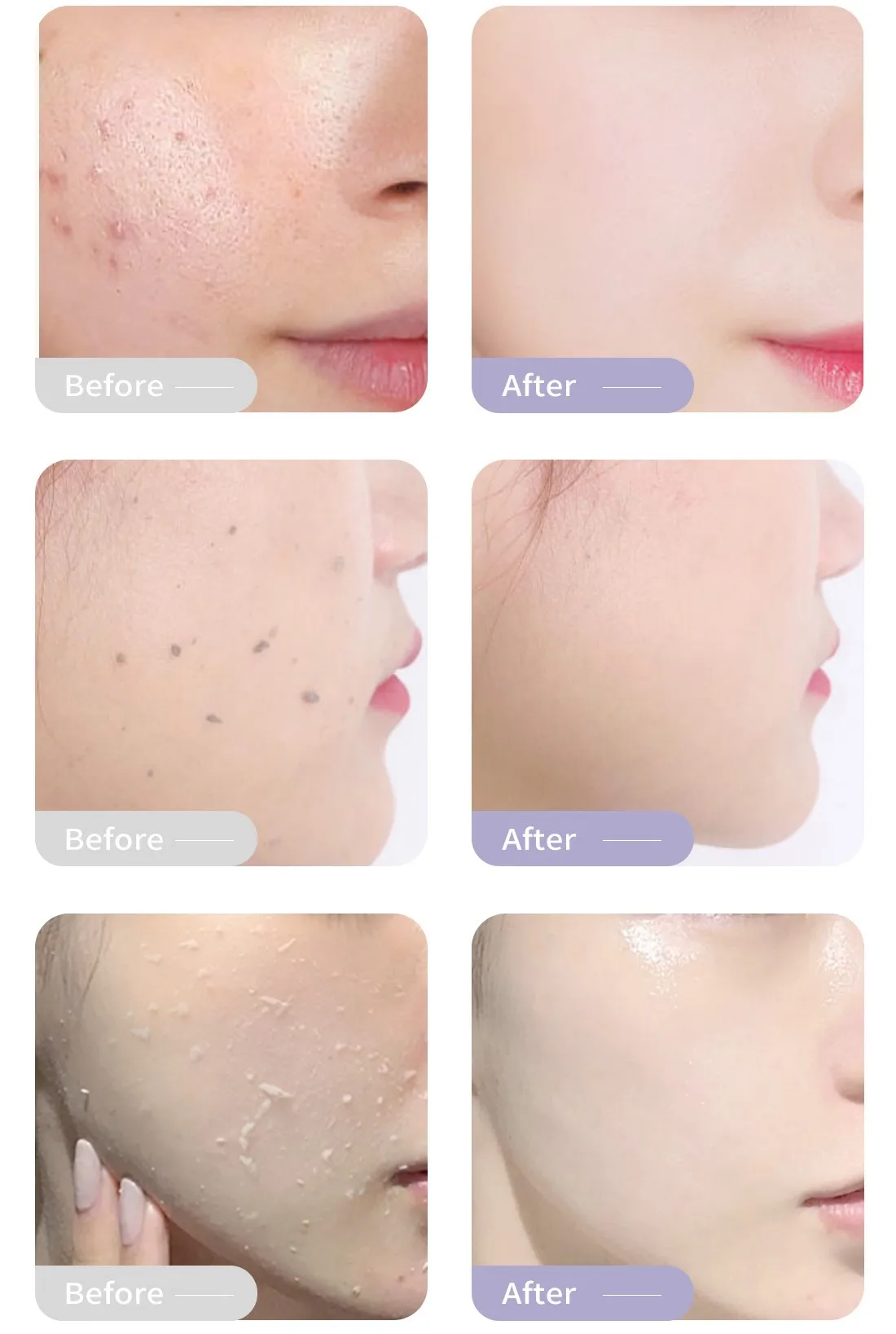 Hot Selling Facial Cleanser Cleaning Keratin Nourishing And Accelerate Metabolism Exfoliating Cream