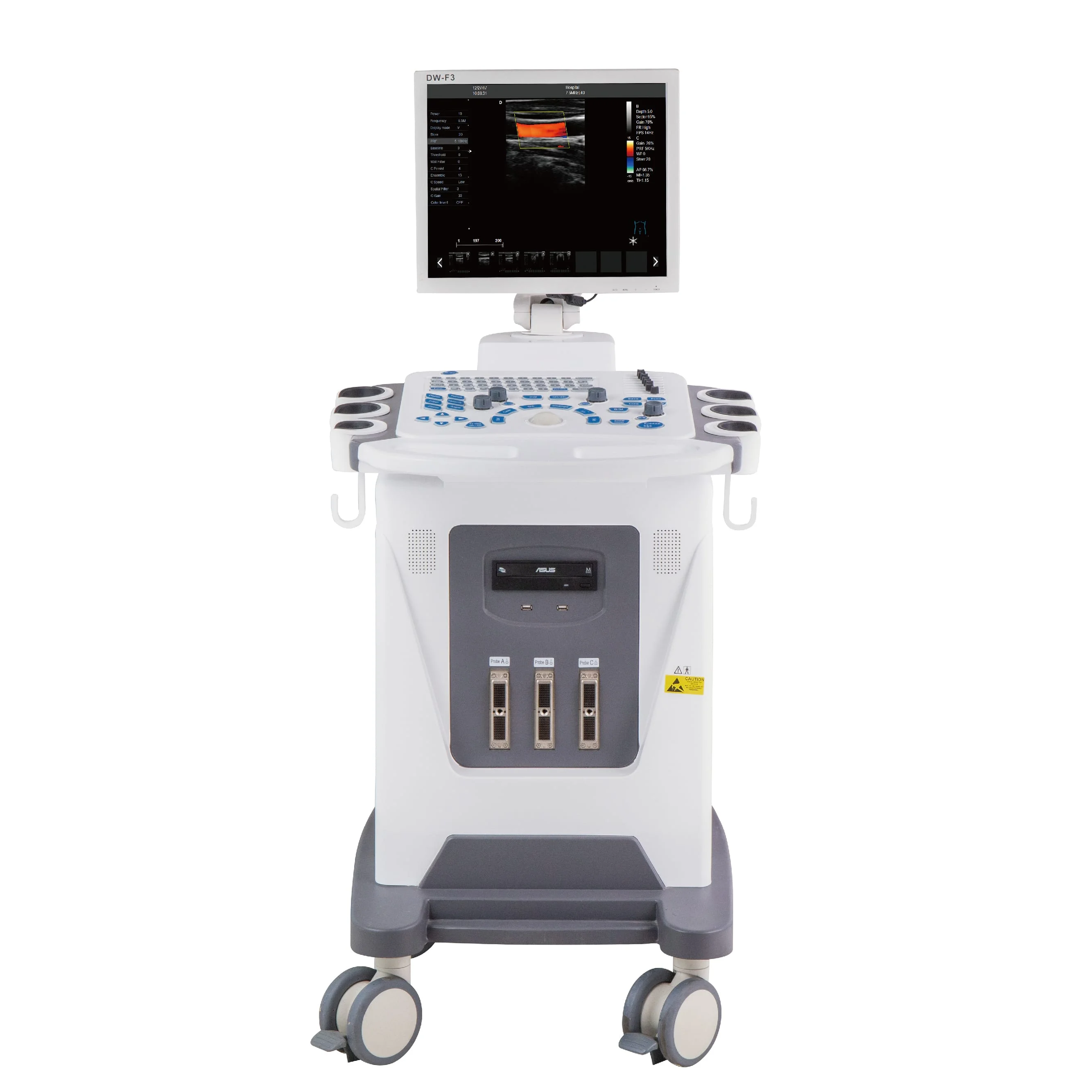 DW-F3 trolley color doppler  medical devices / diagnosis vinno ultrasound like sonoscape