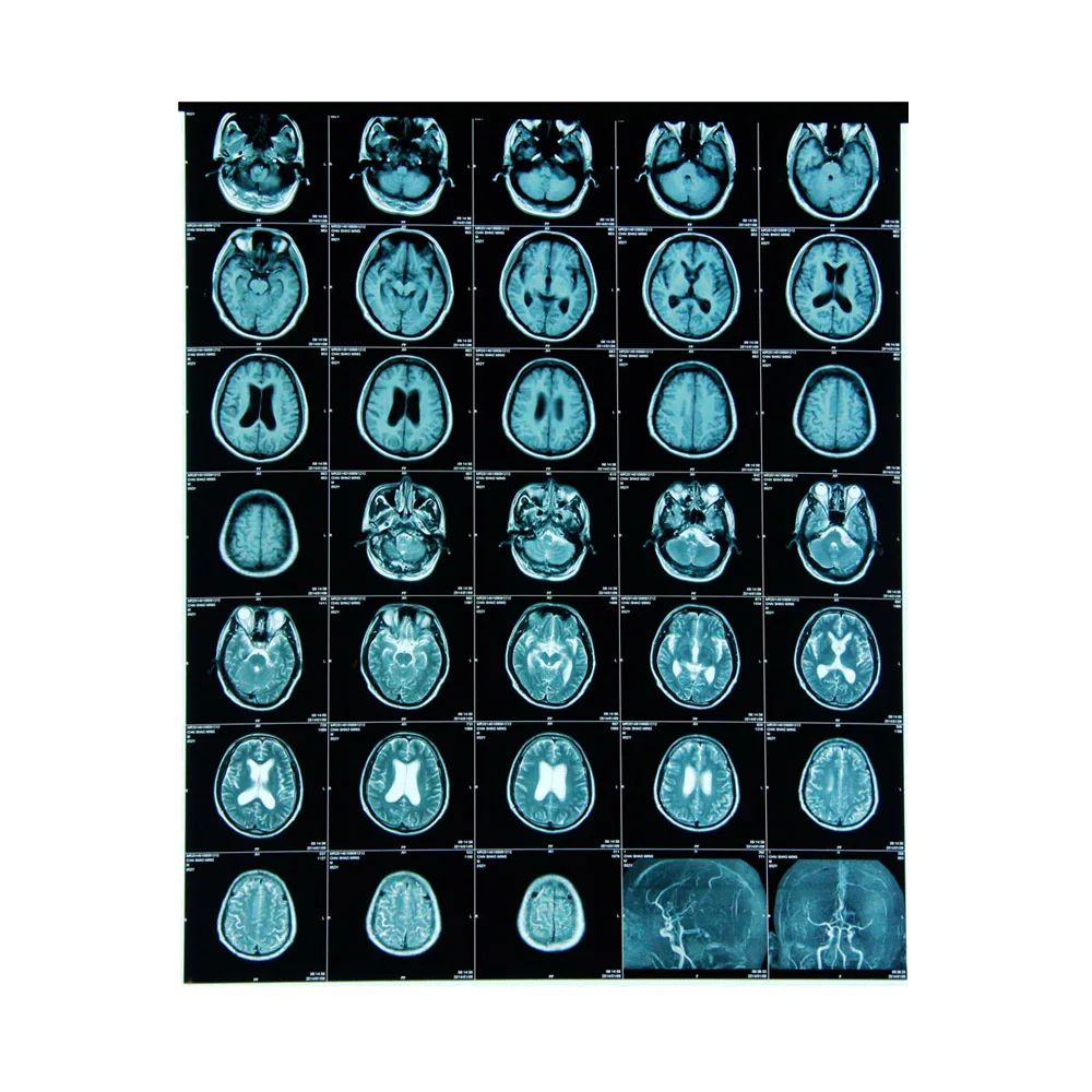 
Wholesale medical dry x-ray film fujifilm DI-HL dry laser imaging film 