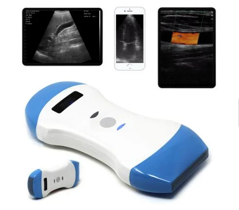 Portable Ultrasound Scanner Doppler Micro Convex USB Wifi Color Wireless Probe Ultrasound Probes