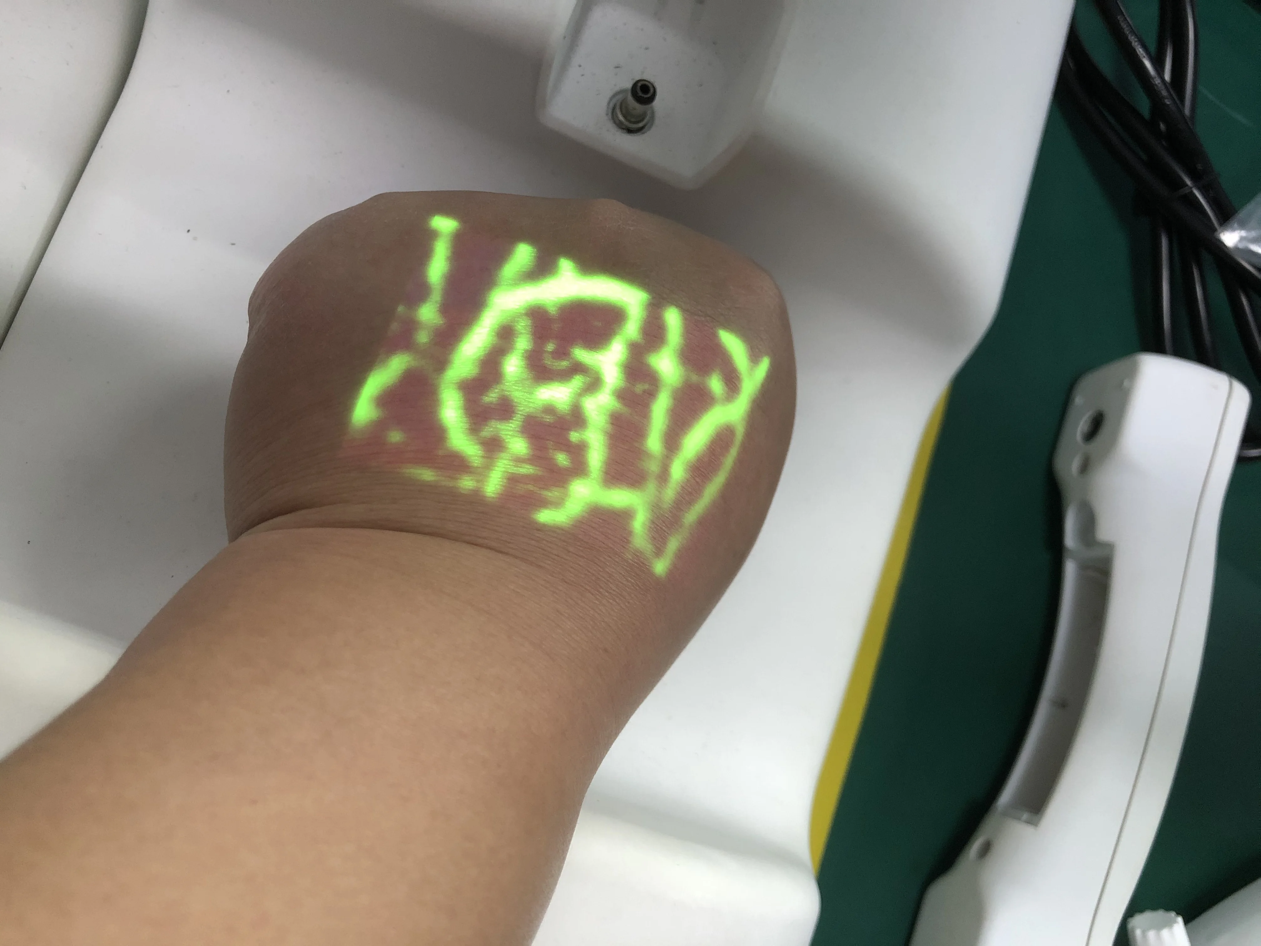 
mobile model medical vein locator infrared adjustable projection vein finders 