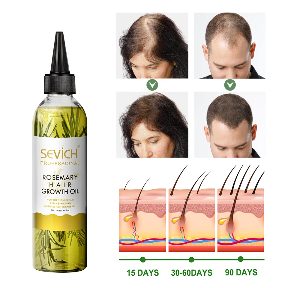 Private Label Organic Argan Hair Oil Pure Rosemary Extract Essential Oil Hair Growth For Hair Loss