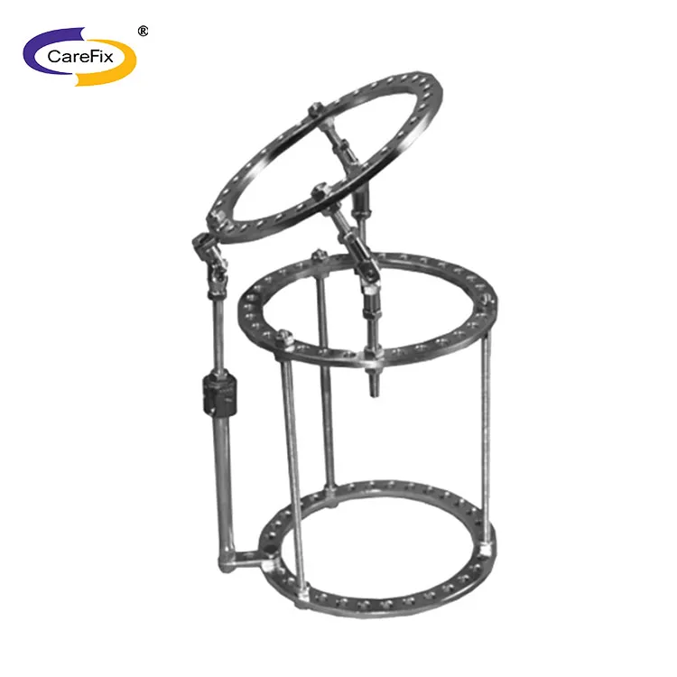 Конструкция бедренных суставов, фрагмент тазового сустава, феморальный внешний фиксатор ilizarov, внешний фиксатор